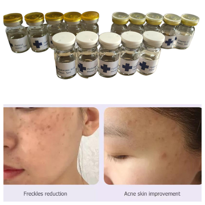 Solution de mésothérapie à base d'acide hyaluronique non lié par Hyamely 5 ml