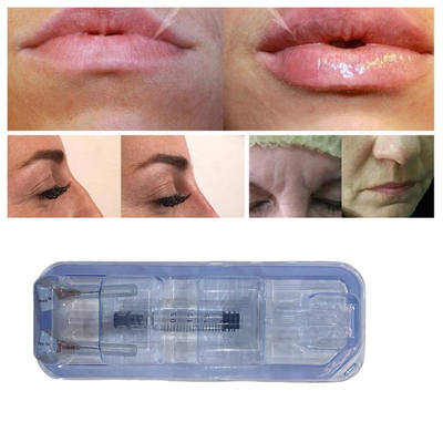 Injectables d'acide hyaluronique pour les lèvres 24 mg/ml