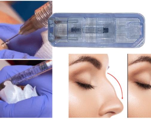 La FDA a approuvé l' injection de gel d' acide hyaluronique pour les fesses.