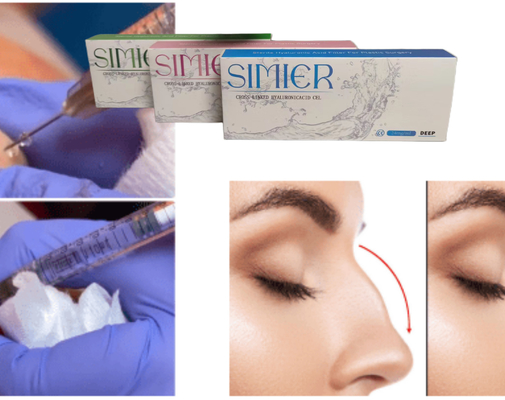 Traitement par injection de gel hyaluronate de sodium transparent de 10 ml pour remplir les lignes du sourire