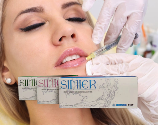Remplisseurs Gel d'acide hyaluronique 5 ml Remplisseur cutané pour lèvres Injections Remplisseur cutané injectable