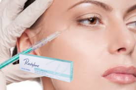 Les lèvres Les joues Acide hyaluronique Filler cutané Refyne Defyne Silk Lyft