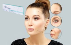 Remplisseur cutané à l' acide hyaluronique 1x1.1 ml Remplisseur labiale