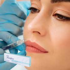 Acide hyaluronique injectable Filler cutané Gel injectable pour les lèvres
