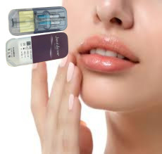 2 X 1 ml de Juvederm Ultra 4 injectables avec remplissage cutané