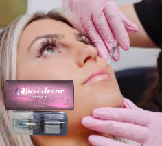 CE Complémentateur de lèvres à l'acide hyaluronique 24 mg/ml Complémentateur de nez Juvederm