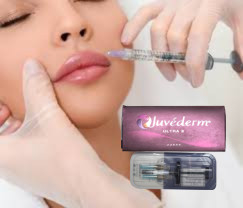 2 X 1 ml de Juvederm Ultra 4 injectables avec remplissage cutané