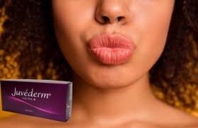 Juvederm Ultra 3 Ultra 4 Filler à l' acide hyaluronique pour améliorer les lèvres