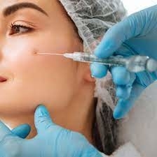 Rides lisses Remplisseur cutané injectable Acide hyaluronique Juvederm Ultra 3 2*1ml
