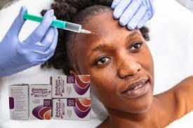 Toxine botulique d'allergène de type A 100 unités injection Botox pour l'hyperhidrose